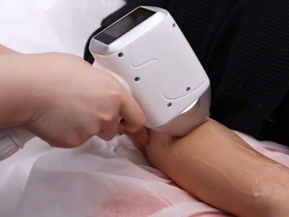 Laserontharing behandeling bij Lasermooi in Utrecht